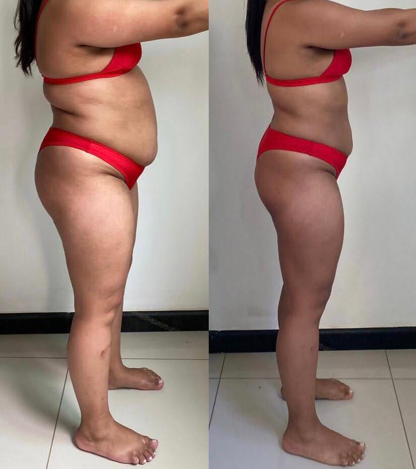 Resultado real — Habitus 360